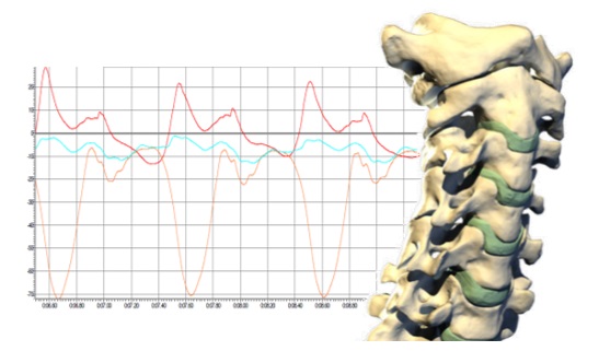 pruebas biomecanicas de algia cervical